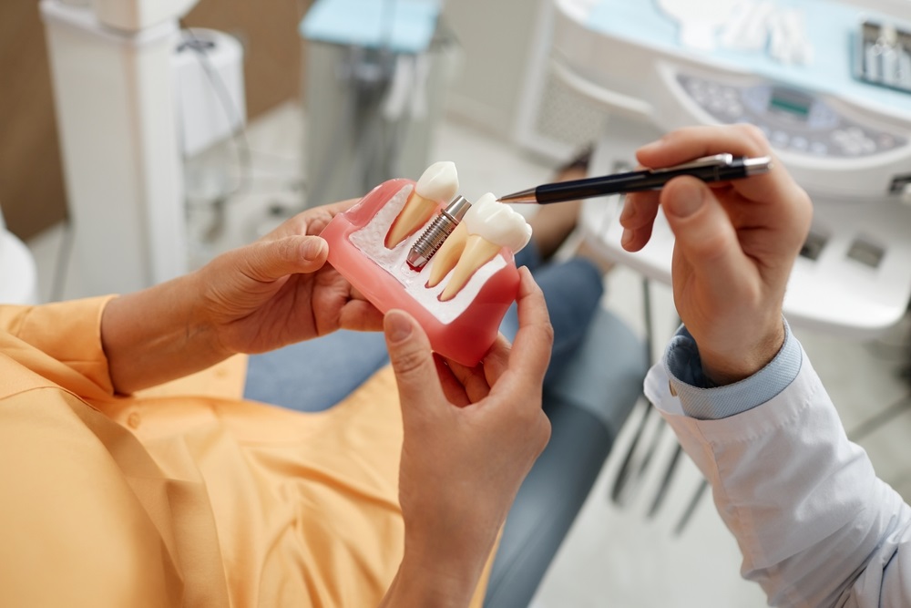 Dentist showing a model of dental implants - Dental Implants in Seattle